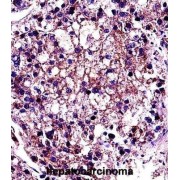 Rho-Related GTP-Binding Protein RhoC (RHOC) Antibody