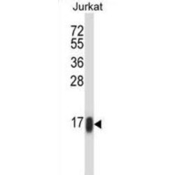 Rho-Related GTP-Binding Protein RhoC (RHOC) Antibody