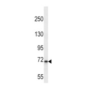 WB analysis of K562 cell line lysates.