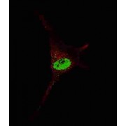 Telomerase Reverse Transcriptase (TERT) Antibody