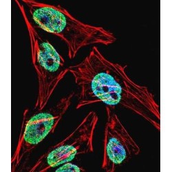 Telomerase Reverse Transcriptase (TERT) Antibody