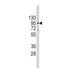 Telomerase Reverse Transcriptase (TERT) Antibody