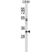 Integrin-Binding Sialoprotein (IBSP) Antibody