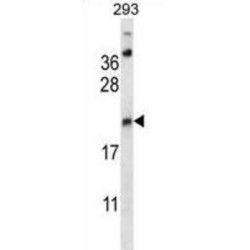 Amino-Terminal Enhancer of Split (AES) Antibody