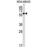 Protein Disulfide Isomerase A5 (PDIA5) Antibody