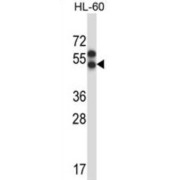 Apelin Receptor (APLNR) Antibody