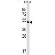 Eukaryotic Translation Elongation Factor 1 Gamma (EEF1G) Antibody