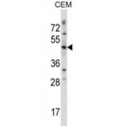 Proto-oncogene Wnt-3 (WNT3) Antibody