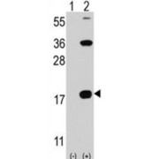 T-Cell Surface Glycoprotein CD3 Zeta Chain (CD247) Antibody