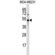 Ubiquitin Carboxyl-Terminal Hydrolase 46 (UBP46) Antibody