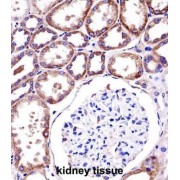 Roquin 1 (RC3H1) Antibody