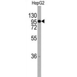 Chordin (CHRD) Antibody