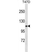 Collagen Type III Alpha 1 (COL3A1) Antibody