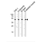 Corepressor Interacting With RBPJ 1 (CIR) Antibody