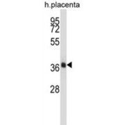 NK2 Homeobox 4 (NKX2-4) Antibody