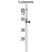 GRAM Domain-Containing Protein 2B (GRAMD3) Antibody