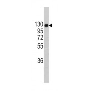 Collagen Type II Alpha 1 (COL2A1) Antibody