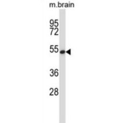 General Transcription Factor IIH, Polypeptide 1 (GTF2H1) Antibody