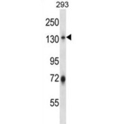 Ring Finger Protein 20 (RNF20) Antibody