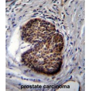 Prostate Stem Cell Antigen (PSCA) Antibody