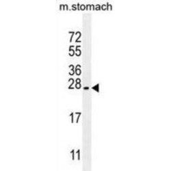 Prostate Stem Cell Antigen (PSCA) Antibody