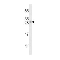 Deoxyuridine Triphosphatase (DUT) Antibody