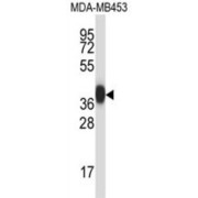 Protease, Serine 8 (PRSS8) Antibody