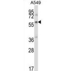 Zinc Finger And BTB Domain-Containing Protein 7A (ZBTB7A) Antibody