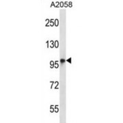 WB analysis of A2058 cell lysates (35 µg).