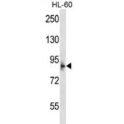 Microcephalin (MCPH1) Antibody