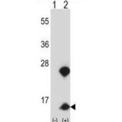 Non-Histone Chromosomal Protein HMG-14 (HMGN1) Antibody