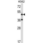 Tachykinin Receptor 3 (TACR3) Antibody