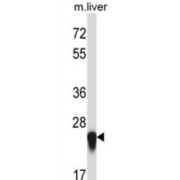 Interleukin-27 Subunit Alpha (IL27) Antibody