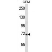 Potassium Voltage-Gated Channel Subfamily D Member 3 (KCND3) Antibody