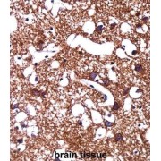 Potassium/Sodium Hyperpolarization-Activated Cyclic Nucleotide-Gated Channel 1 (HCN1) Antibody