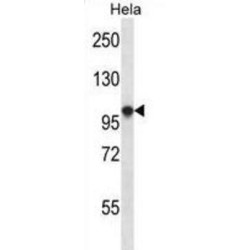 Potassium/Sodium Hyperpolarization-Activated Cyclic Nucleotide-Gated Channel 1 (HCN1) Antibody