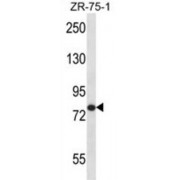 Angiogenic Factor With G Patch And FHA Domains 1 (AGGF1) Antibody