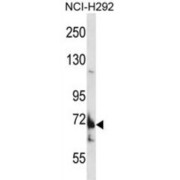 Transmembrane Channel Like 8 (TMC8) Antibody