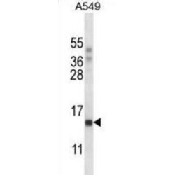 RNA Polymerase II Subunit J (POLR2J) Antibody