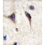 Microtubule-Associated Protein Tau (MAPT) Antibody