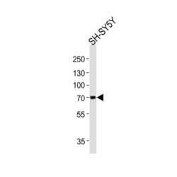 Microtubule-Associated Protein Tau (MAPT) Antibody