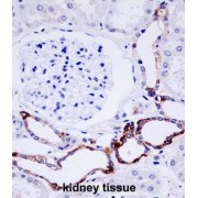 OTU7B Antibody