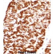 Desmin (DES) Antibody