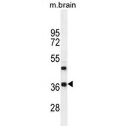 Retinal Homeobox Protein Rx (Rax) Antibody