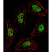 Pituitary Homeobox 2 (PITX2) Antibody