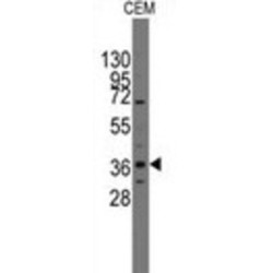 Pituitary Homeobox 2 (PITX2) Antibody