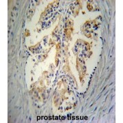 Stanniocalcin-2 (STC2) Antibody