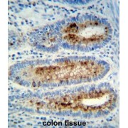 Myeloperoxidase (MPO) Antibody