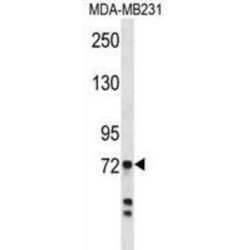 Myeloperoxidase (MPO) Antibody