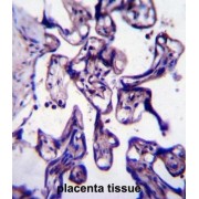 CREB-Regulated Transcription Coactivator 2 (CRTC2) Antibody